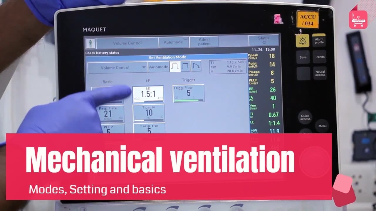 Mechanical Ventilation: Basics, Modes & Settings Explained