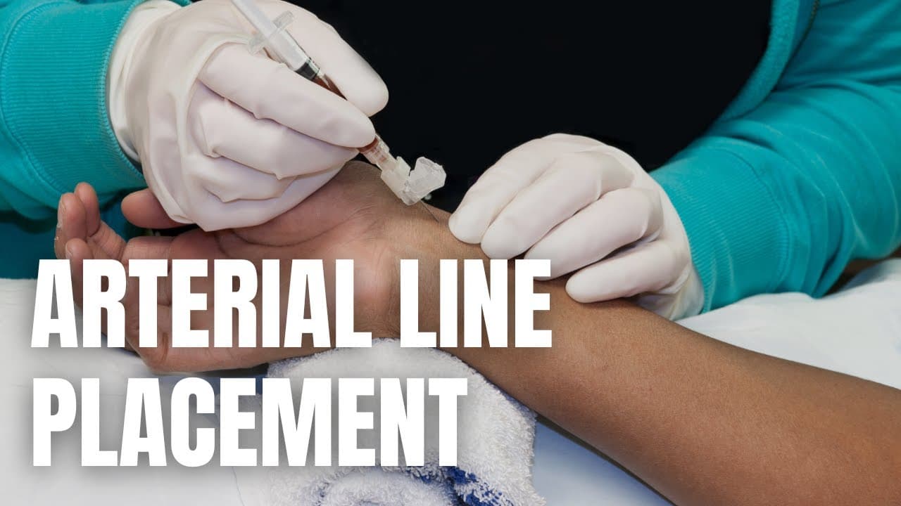 Arterial Line Placement: Complete Step-by-Step Guide for Clinicians