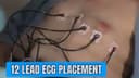 12 lead ECG: Placement of leads properly
