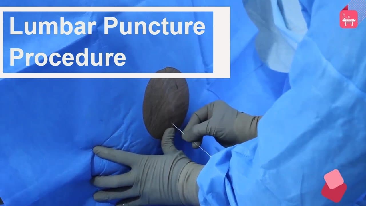 #Lumbar Puncture (#spinal #Tapping): Step by step procedure