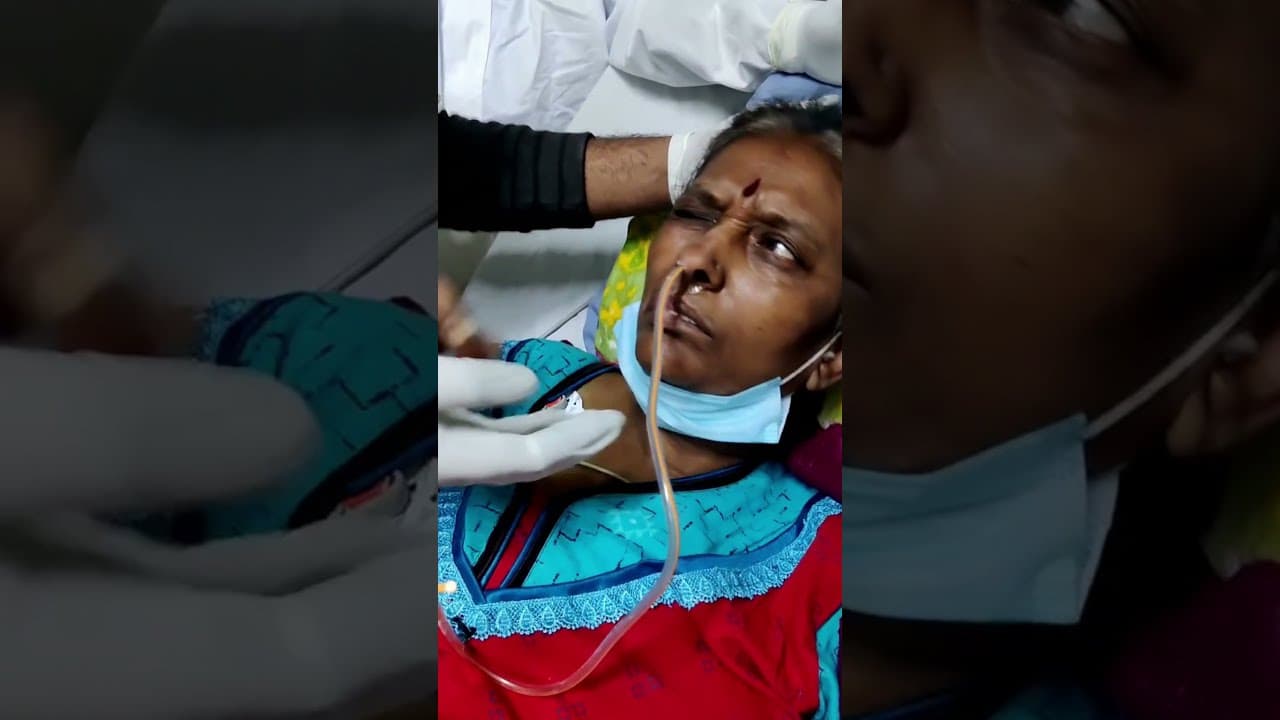 Insertion of a #Nasogastric #Tube into a Difficult #Patient