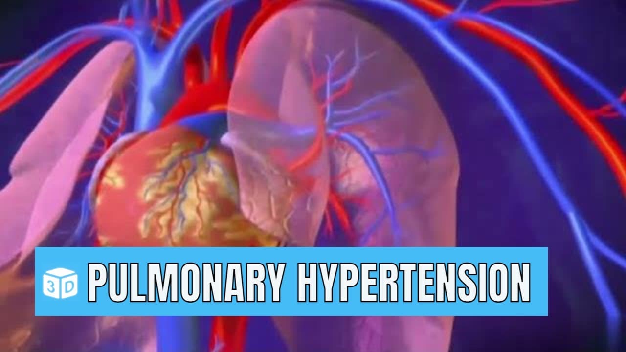 Pulmonary hypertension Animated 3D