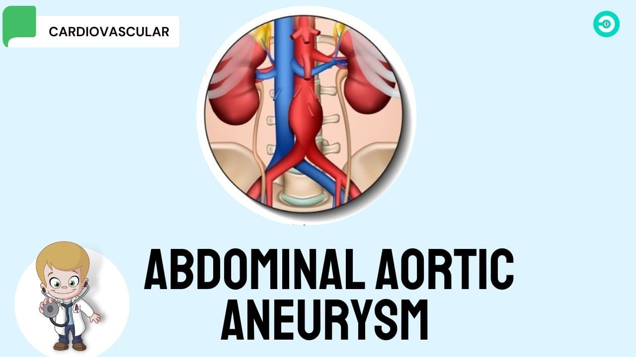Abdominal aortic aneurysm (AAA): causes, screening & Treatment