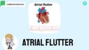 Atrial Flutter: symptoms, ECG features and Treatment options