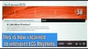 Learn to #interpret #ECG rhythm with the #game