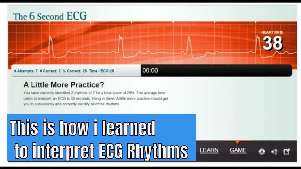 Learn to #interpret #ECG rhythm with the #game