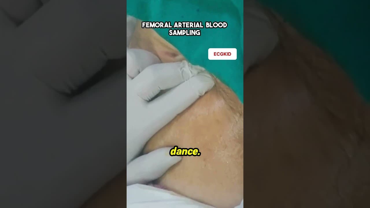 Femoral arterial blood sampling #medicaleducation #icu #abgprocedure