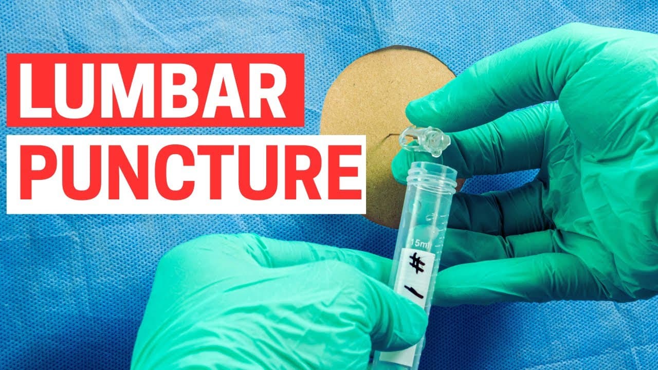 Spinal Tap (Lumbar Puncture) – Step-by-Step Procedure for Clinicians
