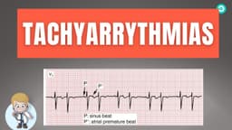 How to dignose Abnormal heart rhythm (Tachyarrythmias) On ECG : Step by step