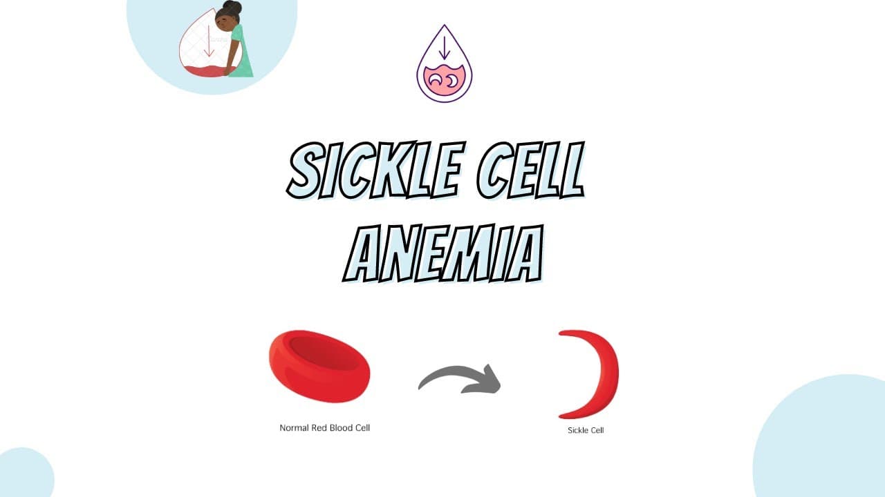 Sickle cell anemia : What is it and how it affect our body?