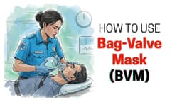 How to Use a Bag-Valve Mask (BVM) in Emergencies – A Life-Saving Guide