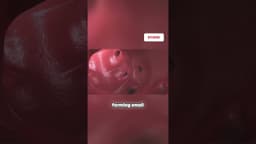 Diverticulitis explained! 3D animation #medicaleducation #guthealth #doctor