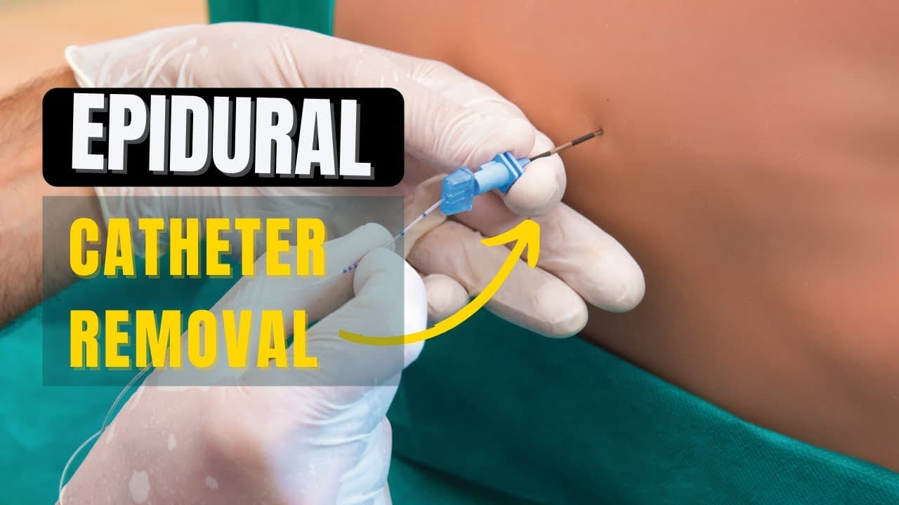 How to Remove Epidural Catheter safely