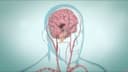 What Really Happens During an Ischemic Stroke? 🧠 (Animated Explanation)