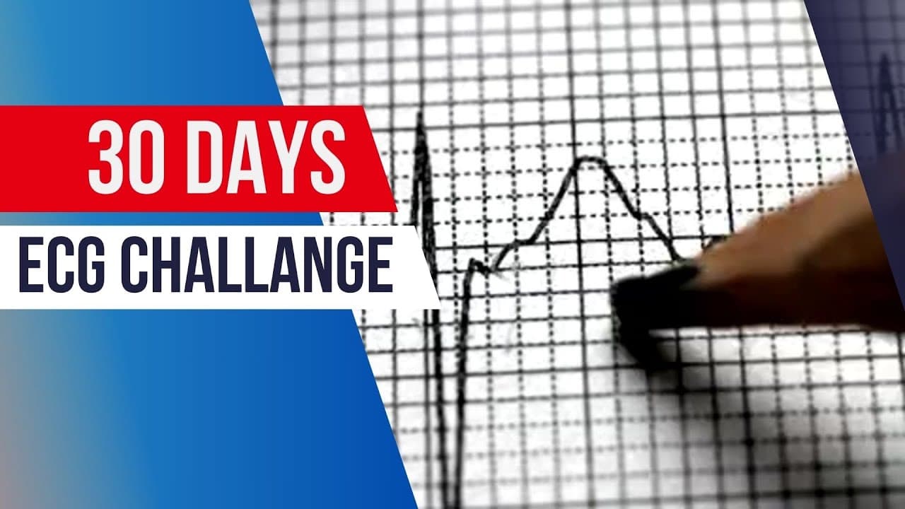 DAY 0 | Mastering #ECG Interpretation: 30-Day #Challenge