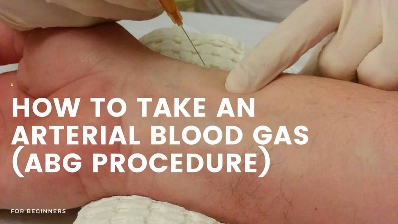 How to take blood for ABG | Radial Artery