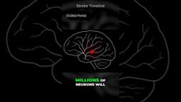 CRUCIAL First Hour After Stroke timeline explained