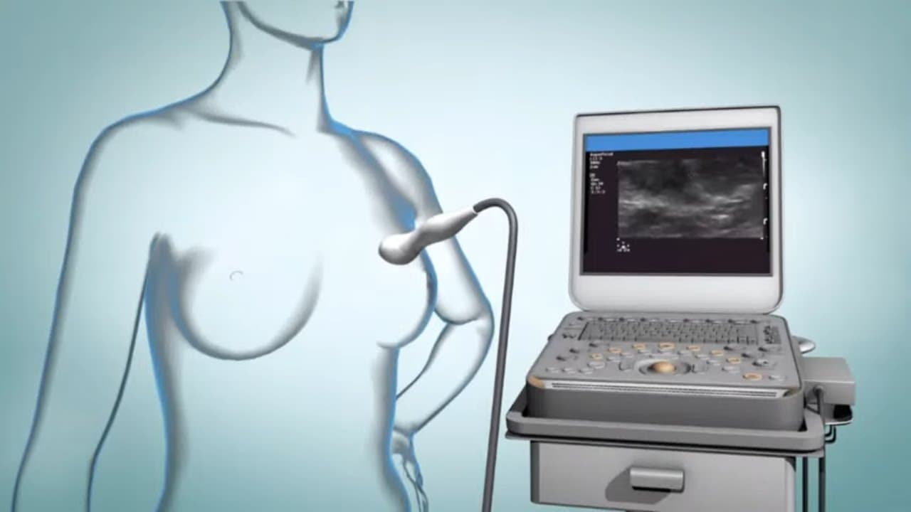 Mammogram (Breast cancer screening) and diagnostic methods