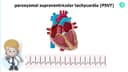 Supraventricular Tachycardia (SVT) Explained: Types & ECG Features