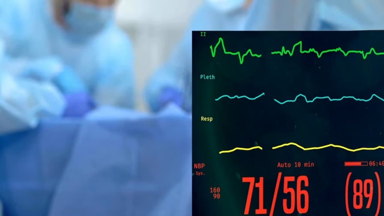 Why severe hypotension immediately after intubation? How to deal with it.