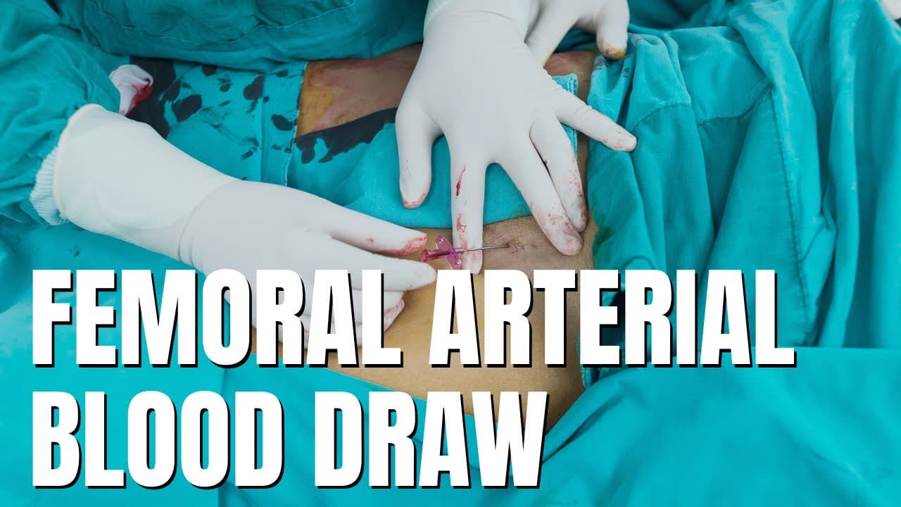 Femoral ABG Procedure in ICU: Step-by-Step Guide