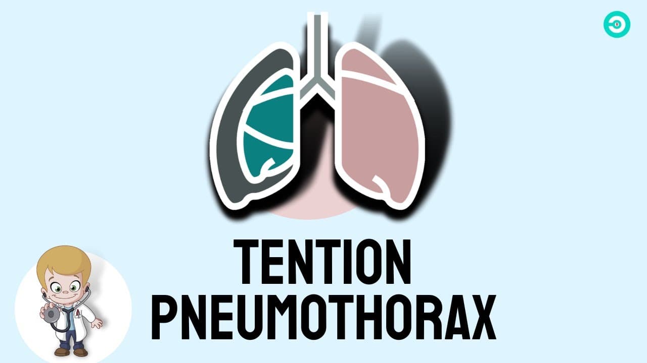 Tension Pneumothorax explained | USMLE