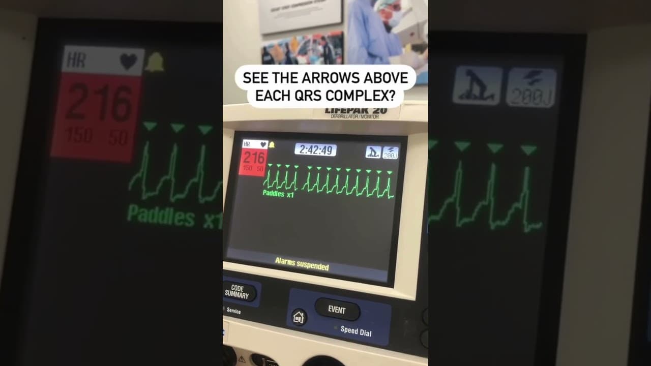 Doctors Reveal EASY Fix for Abnormal Heart Rhythm