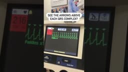 Doctors Reveal EASY Fix for Abnormal Heart Rhythm