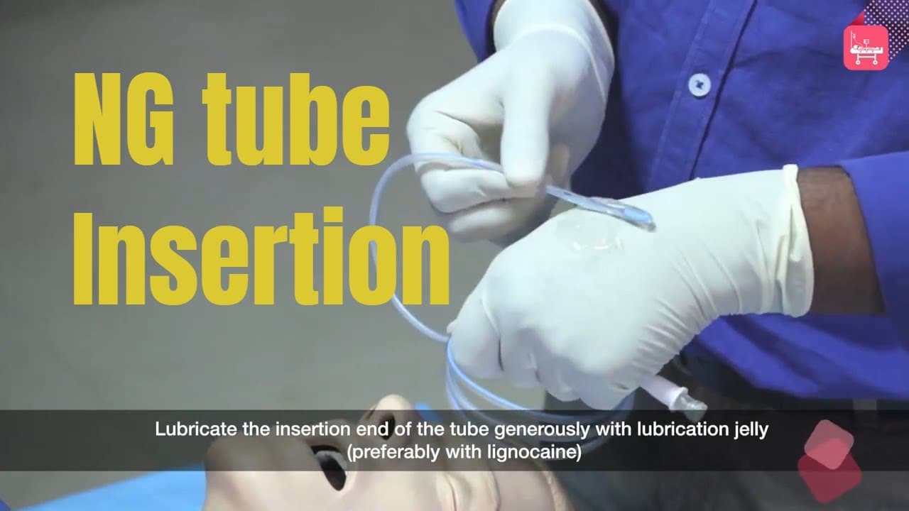 Nasogastric Tube Insertion & Management | Step-by-Step Clinical Guide