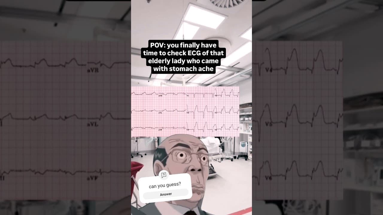 When you are ignorant 😒 #ECG #doctor #medicine