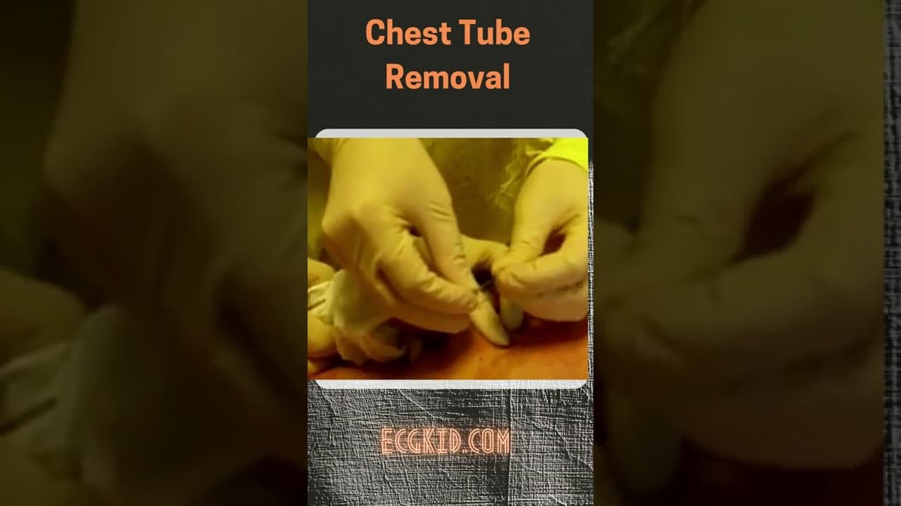 How to remove chest tube properly #doctor