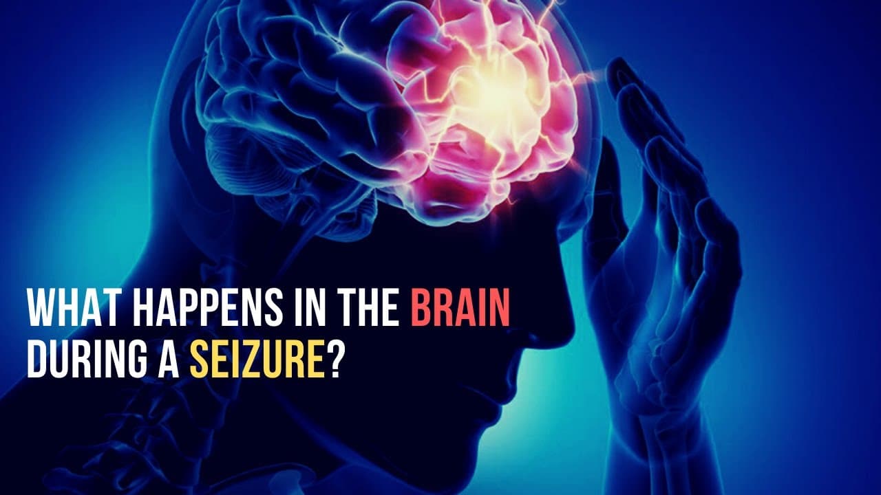 What happens in #Brain during #Seizure: #Neurobiology.