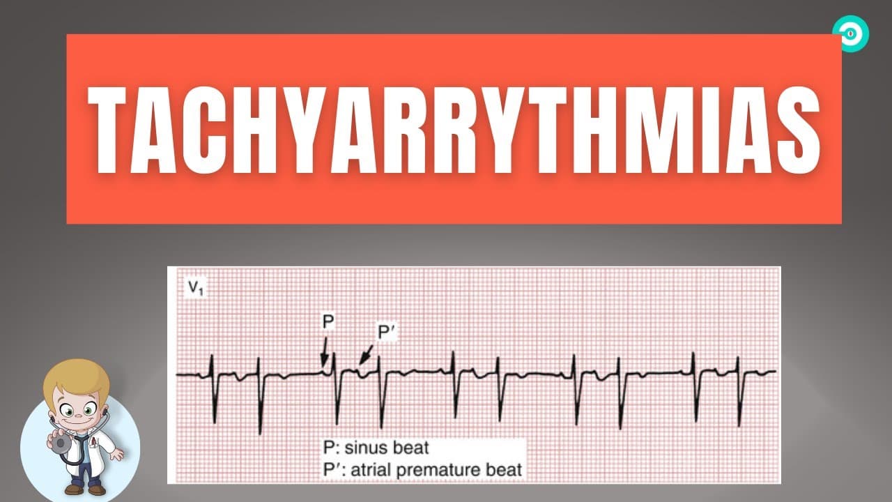 How to dignose Abnormal heart rhythm (Tachyarrythmias) On ECG : Step by step