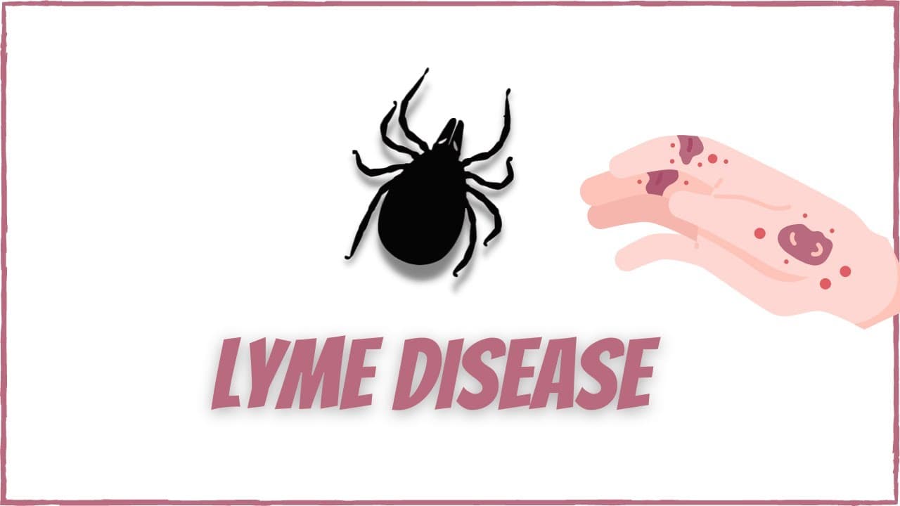 Lyme Disease: Signs and symptoms, diagnosis and treatment